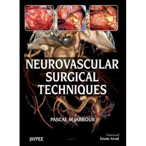 NEUROVASCULAR SURGICAL TECHNIQUES