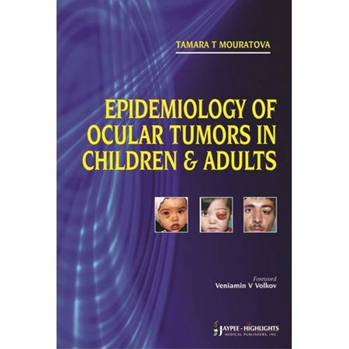 EPIDEMIOLOGY OF OCULAR TUMORS IN CHILDREN & ADULTS