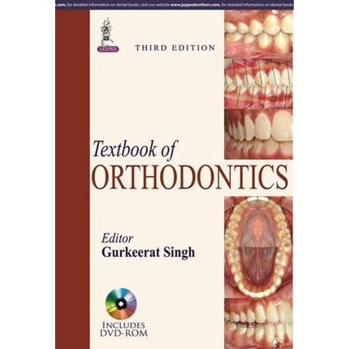 TEXTBOOK OF ORTHODONTICS