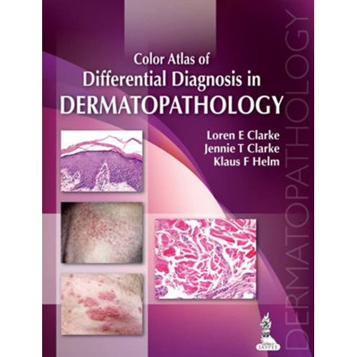 COLOR ATLAS OF DIFFERENTIAL DIAGNOSIS IN DERMATOPATHOLOGY