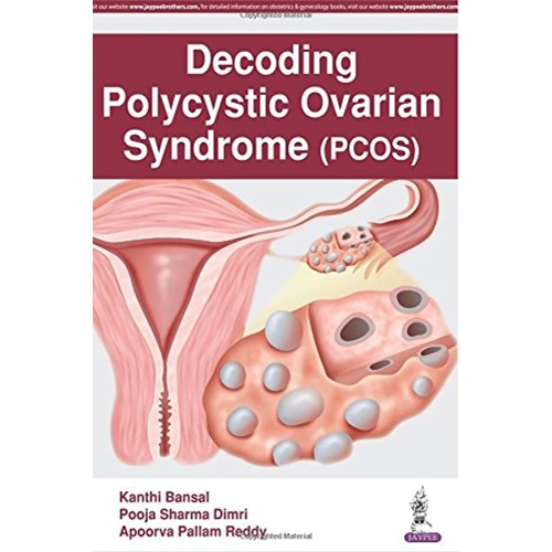 DECODING POLYCYSTIC OVARIAN SYNDROME (PCOS)