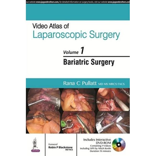 VIDEO ATLAS OF LAPAROSCOPIC SURGERY VOL.1 BAR...