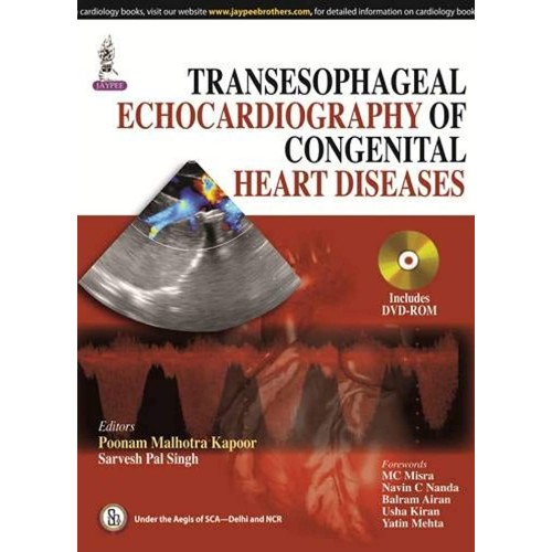 TRANSESOPHAGEAL ECHOCARDIOGRAPHY OF CONGENITA...