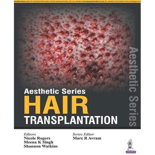 AESTHETIC SERIES:HAIR TRANSPLANTATION