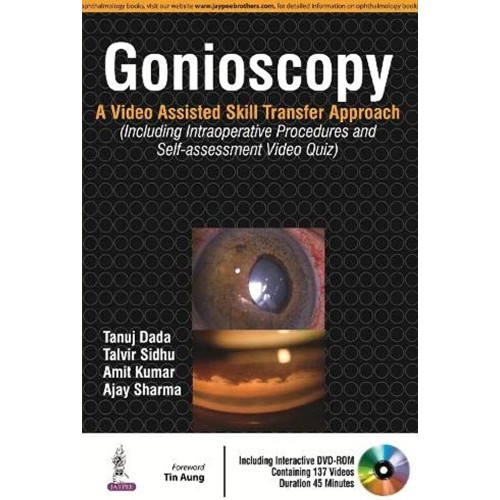 GONIOSCOPY:A VIDEO ASSISTED SKILL TRANSFER APPROACH WITH DVD-ROM