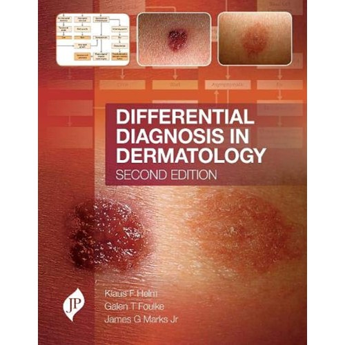 DIFFERENTIAL DIAGNOSIS IN DERMATOLOGY