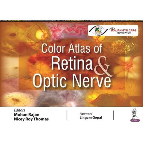 COLOR ATLAS OF RETINA & OPTIC NERVE