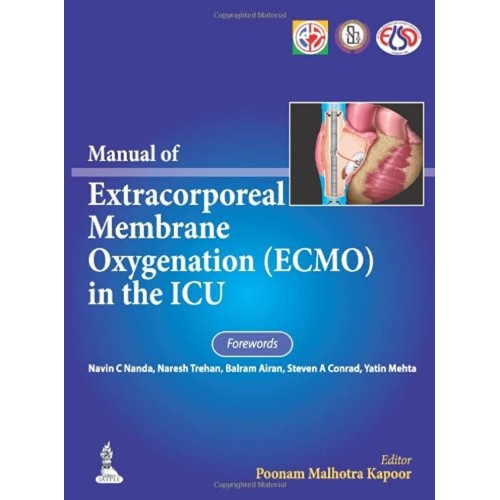 MANUAL OF EXTRACORPOREAL MEMBRANE OXYGENATION (ECMO) IN THE ICU