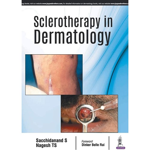 SCLEROTHERAPY IN DERMATOLOGY