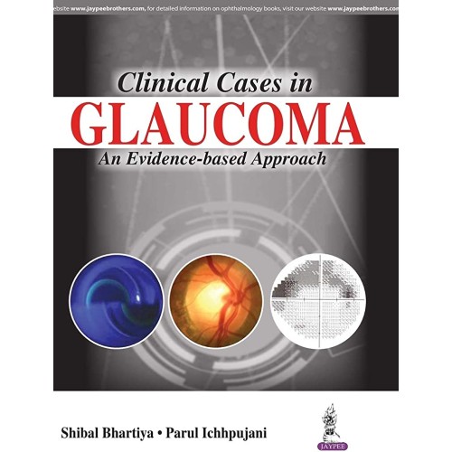 CLINICAL CASES IN GLAUCOMA AN EVIDENCE-BASED APPROACH