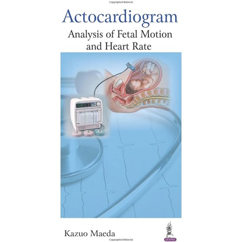 ACTOCARDIOGRAM:ANALYSIS OF FETAL MOTION AND H...