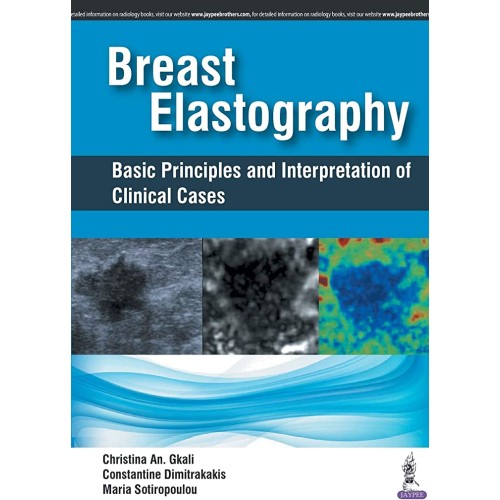 BREAST ELASTOGRAPHY BASIC PRINCIPLES AND INTERPRETATION OF CLINICAL CASES