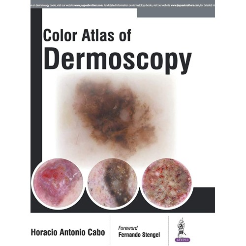 COLOR ATLAS OF DERMOSCOPY