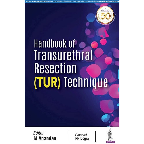 HANDBOOK OF TRANSURETHRAL RESECTION (TUR) TECHNIQUE