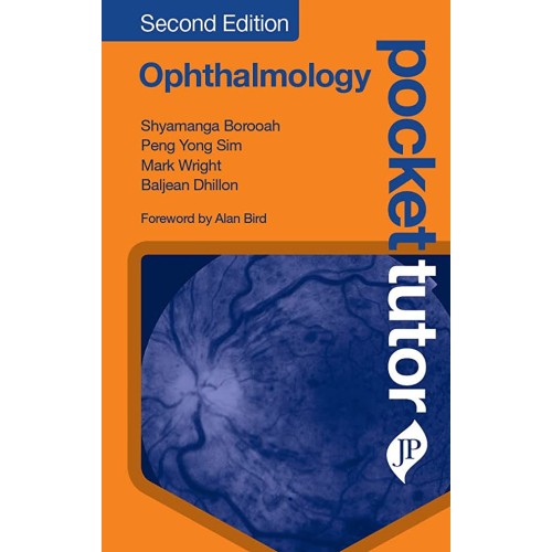 OPHTHALMOLGY:POCKET TUTOR