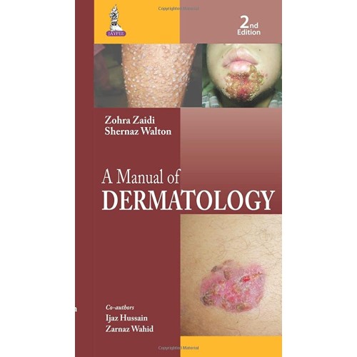 A MANUAL OF DERMATOLOGY