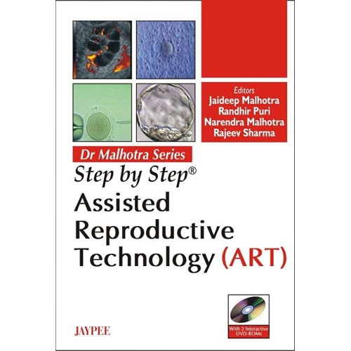 STEP BY STEP ASSISTED REPRODUCTIVE TECHNOLOGY...