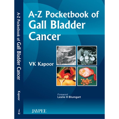 A-Z POCKET BOOK OF GALL BLADDER CANCER