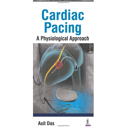 CARDIAC PACING A PHYSIOLOGICAL APPROACH