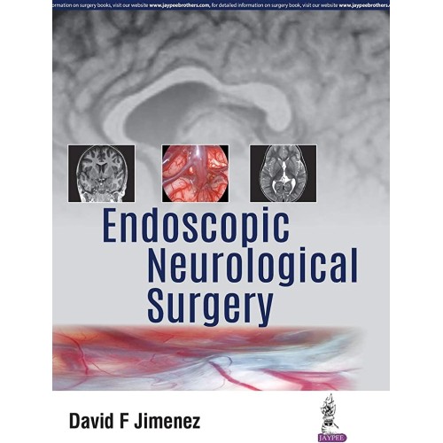 ENDOSCOPIC NEUROLOGICAL SURGERY