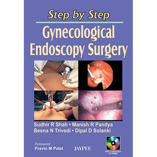 STEP BY STEP GYNECOLOGICAL ENDOSCOPY SURGERY ...