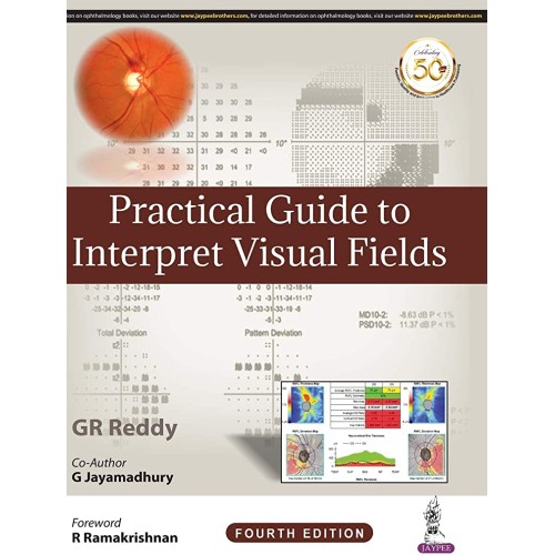 PRACTICAL GUIDE TO INTERPRET VISUAL FIELDS