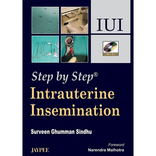 STEP BY STEP INTRAUTERINE INSEMINATION IUI WI...