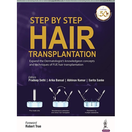 STEP BY STEP HAIR TRANSPLANTATION