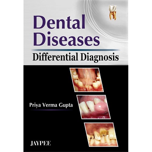 DENTAL DISEASES DIFFERENTIAL DIAGNOSIS