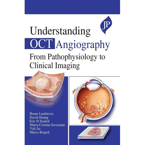 UNDERSTANDING OCT ANGIOGRAPHY FROM PATHOPHYSI...