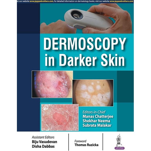 DERMOSCOPY IN DARKER SKIN