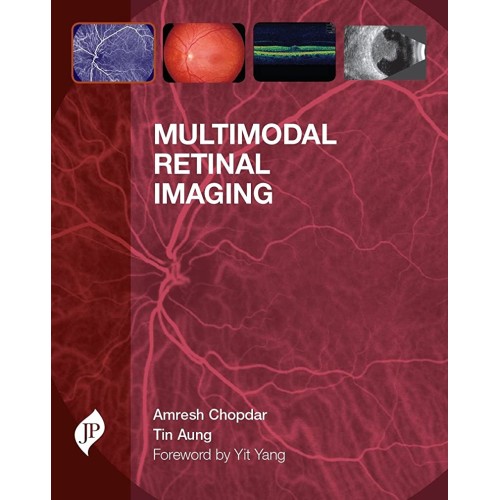 MULTIMODAL RETINAL IMAGING