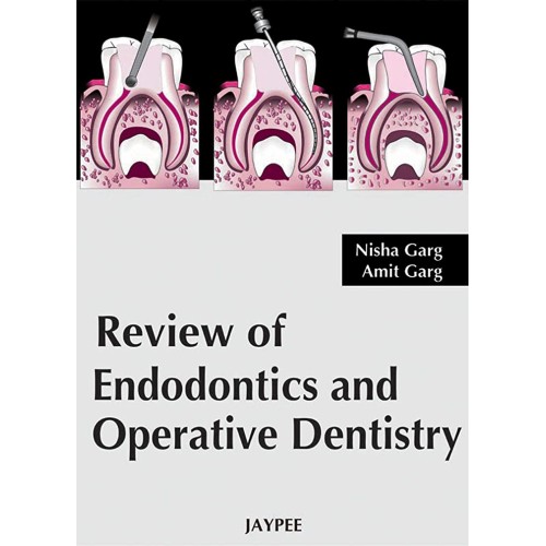 REVIEW OF ENDODONTICS AND OPERATIVE DENTISTRY