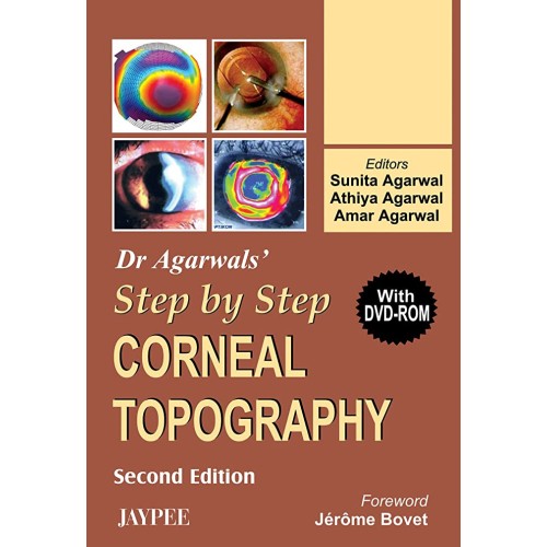 DR. AGARWALS' STEP BY STEP CORNEAL TOPOGRAPHY WITH DVD-ROM