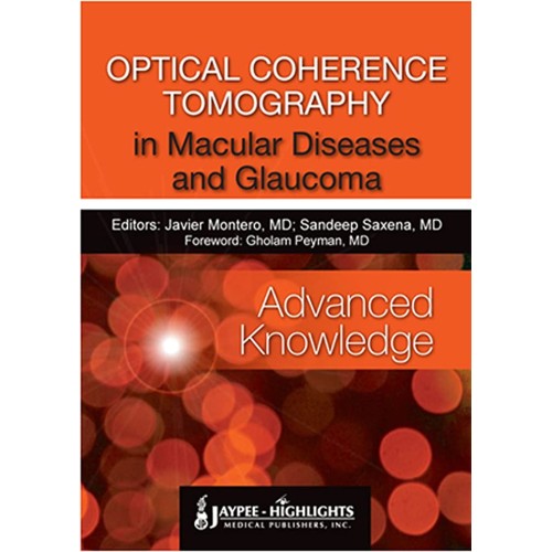 OPTICAL COHERENCE TOMOGRAPHY IN MACULAR DISEA...