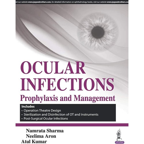 OCULAR INFECTIONS PROPHYLAXIS AND MANAGEMENT