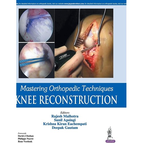 MASTERING ORTHOPEDIC TECHNIQUES KNEE RECONSTRUCTION