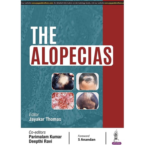 THE ALOPECIAS