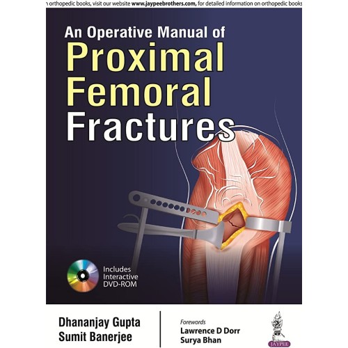 AN OPERATIVE MANUAL OF PROXIMAL FEMORAL FRACT...