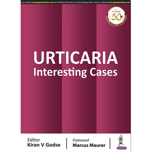 URTICARIA: INTERESTING CASES