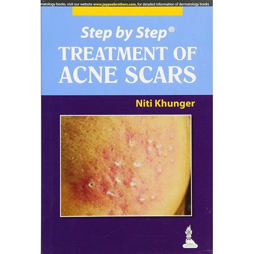 STEP BY STEP TREATMENT OF ACNE SCARS