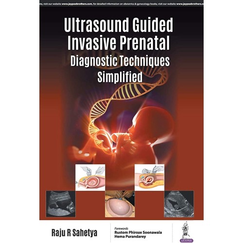 ULTRASOUND GUIDED INVASIVE PRENATAL DIAGNOSTI...