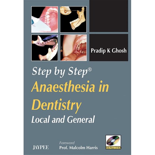 STEP BY STEP ANAESTHESIA IN DENTISTRY LOCAL A...