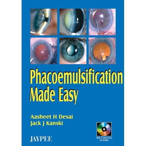 PHACOEMULSIFICATION MADE EASY WITH 2 INT.CD R...