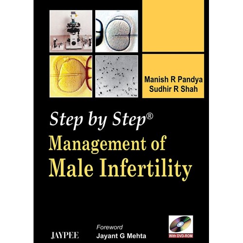 STEP BY STEP MANAGEMENT OF MALE INFERTILITY W...