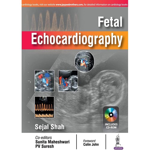 FETAL ECHOCARDIOGRAPHY