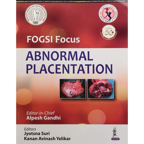 FOGSI FOCUS ABNORMAL PLACENTATION