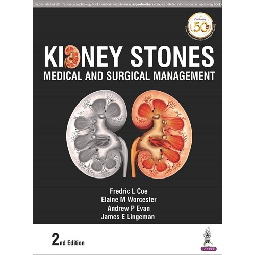 KIDNEY STONES: MEDICAL AND SURGICAL MANAGEMEN...