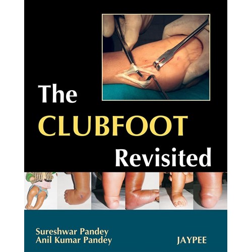 THE CLUBFOOT REVISITED