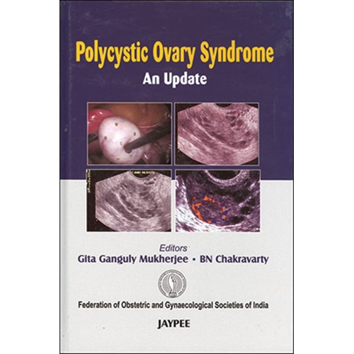 POLYCYSTIC OVARY SYNDROME AN UPDATE (FOGSI)